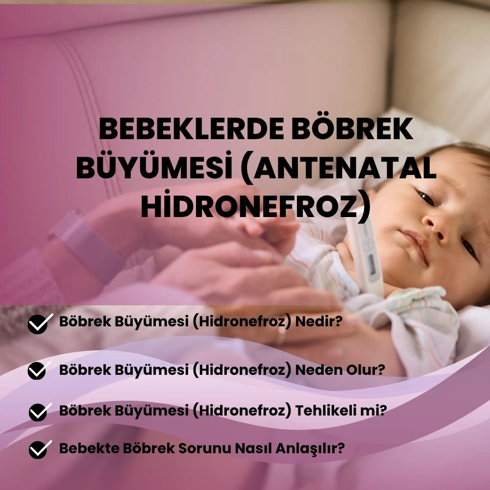 Bebeklerde böbrek büyümesi antenatal hidronefroz