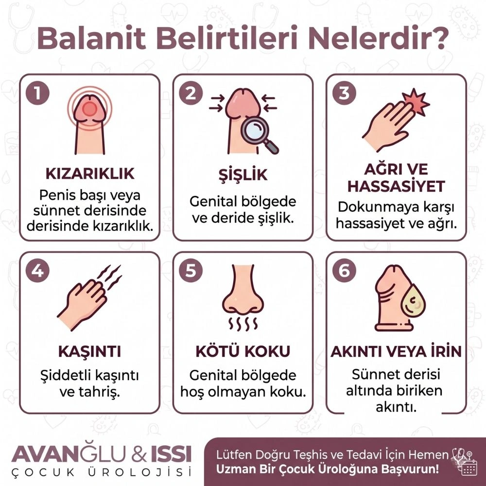 balanit tedavisi