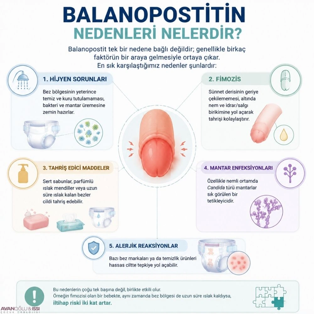 balanopostit nedenleri