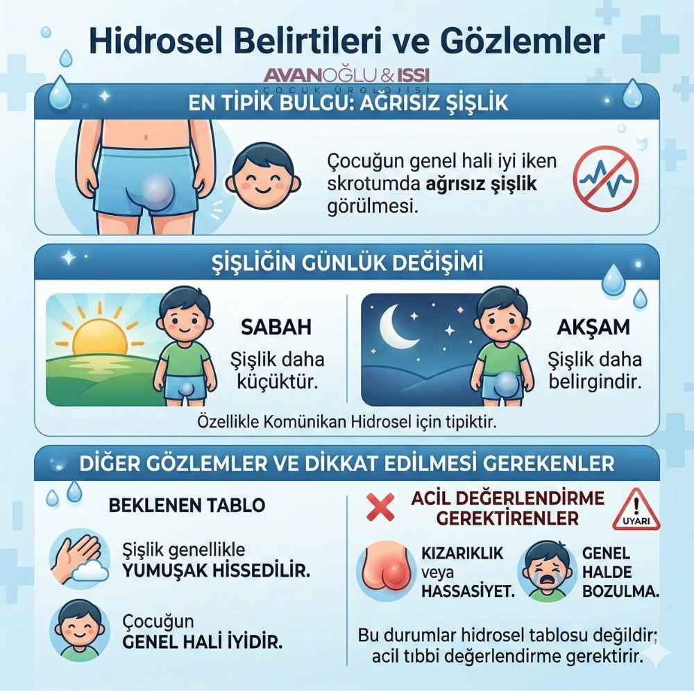 Su fıtığı Belirtileri