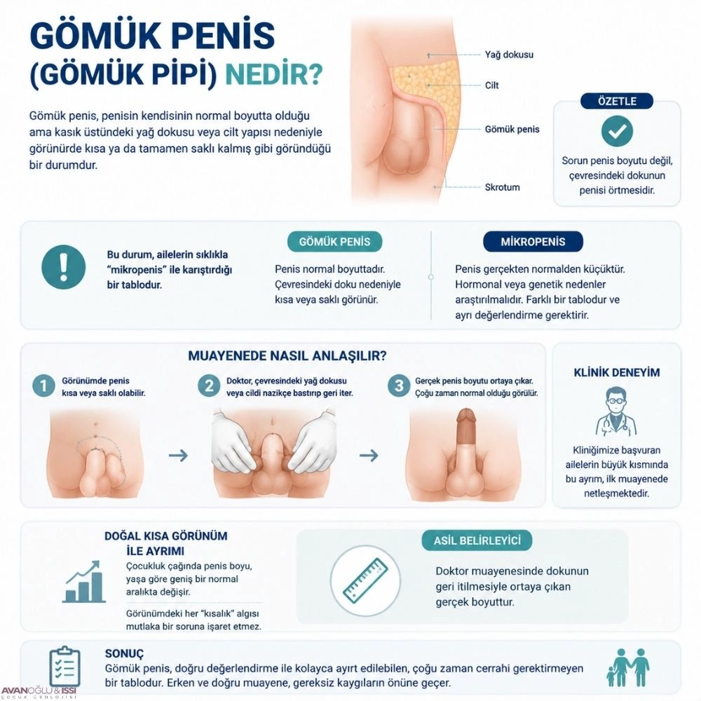 gömük penis