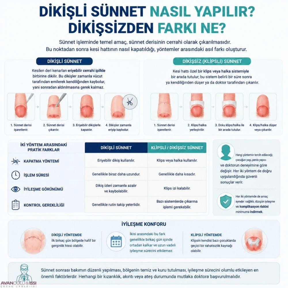 sünnet dikişleri ne zaman düşer