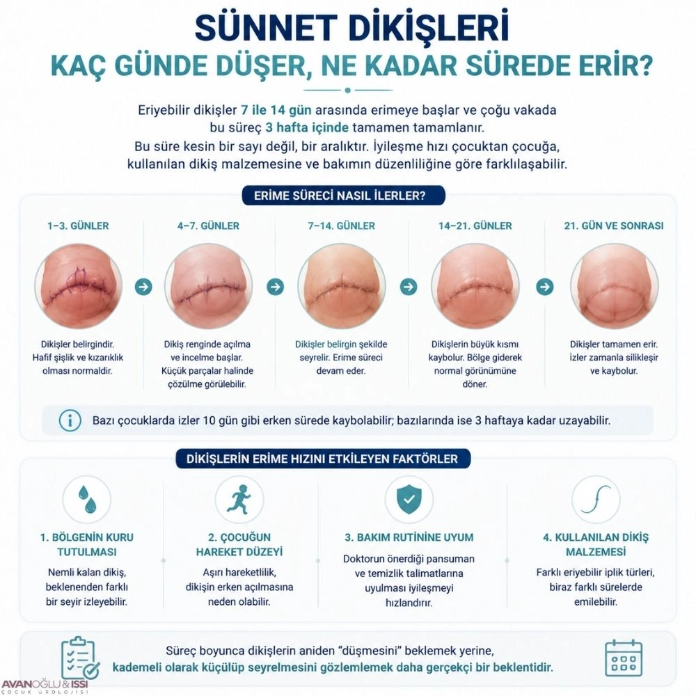 Sünnet Dikişleri Kaç Günde erir