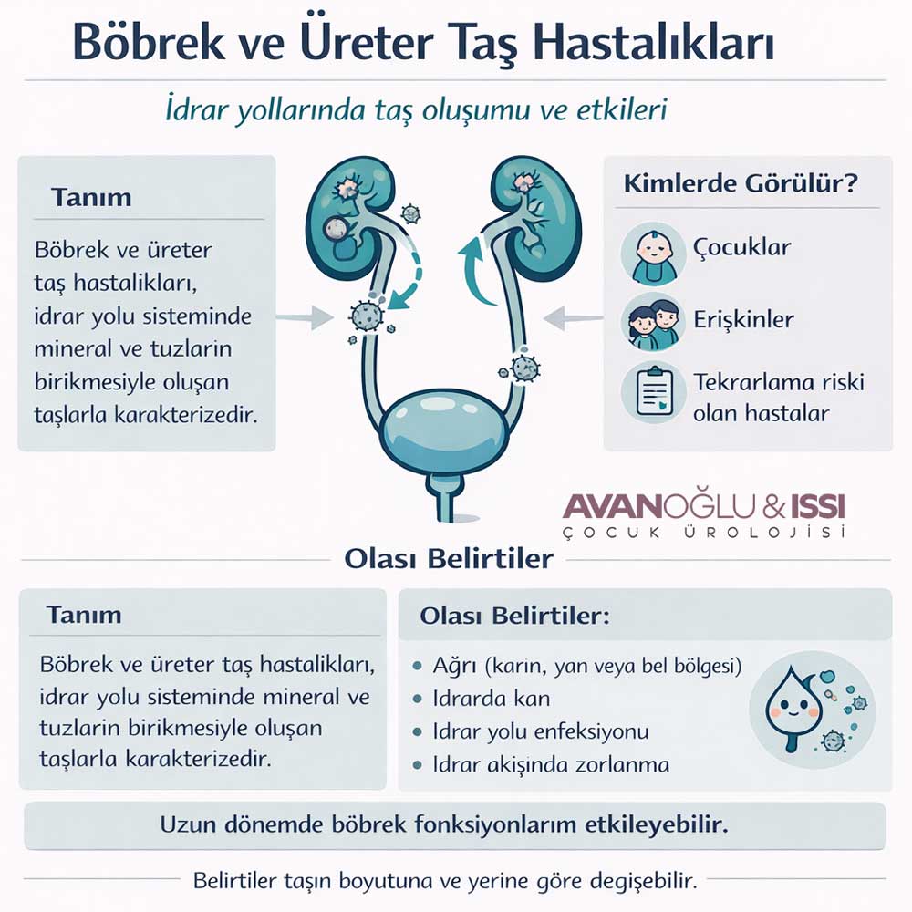 cocuklarda böbrek tasi tedavisi